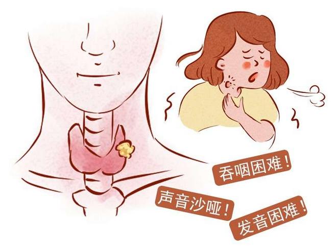 體檢時發(fā)現(xiàn)甲狀腺結(jié)節(jié)怎么辦？